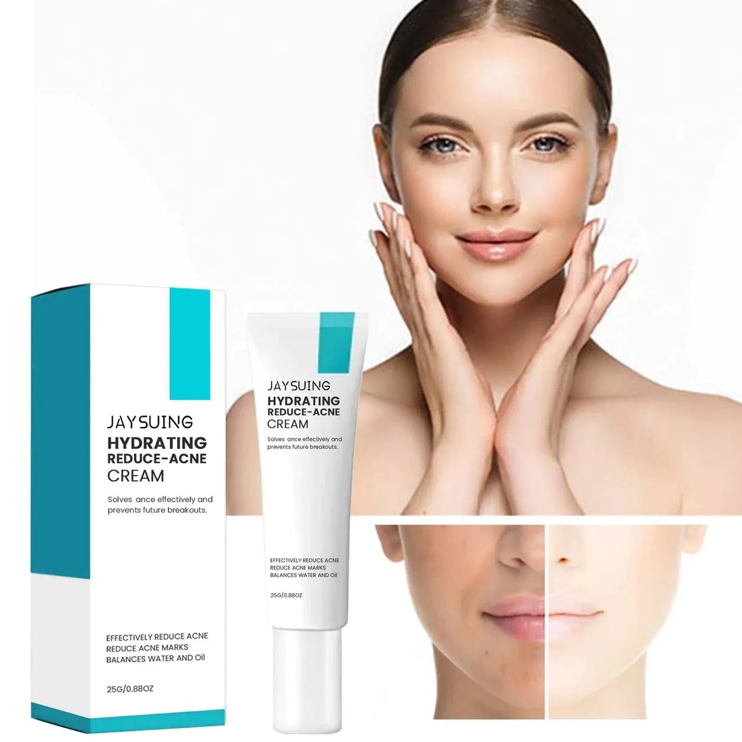 Jaysuing Whitening Anti-Acne Cream applied on acne-prone skin