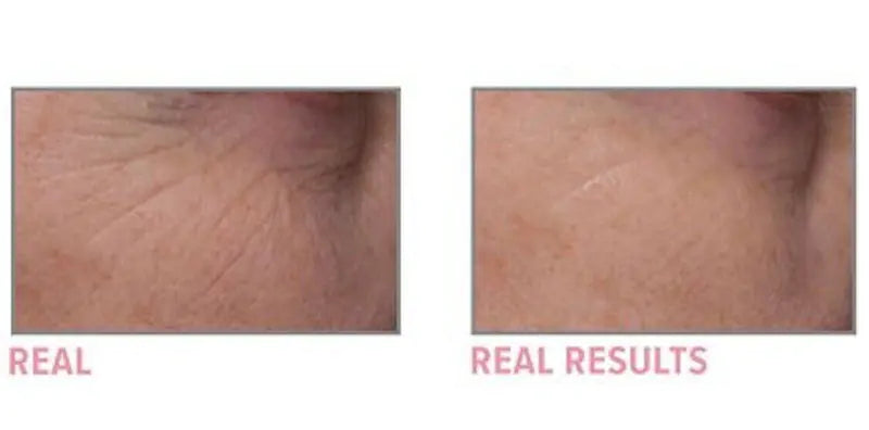 Super Moisturizing Anti-Wrinkle Face Cream – Firming Formula