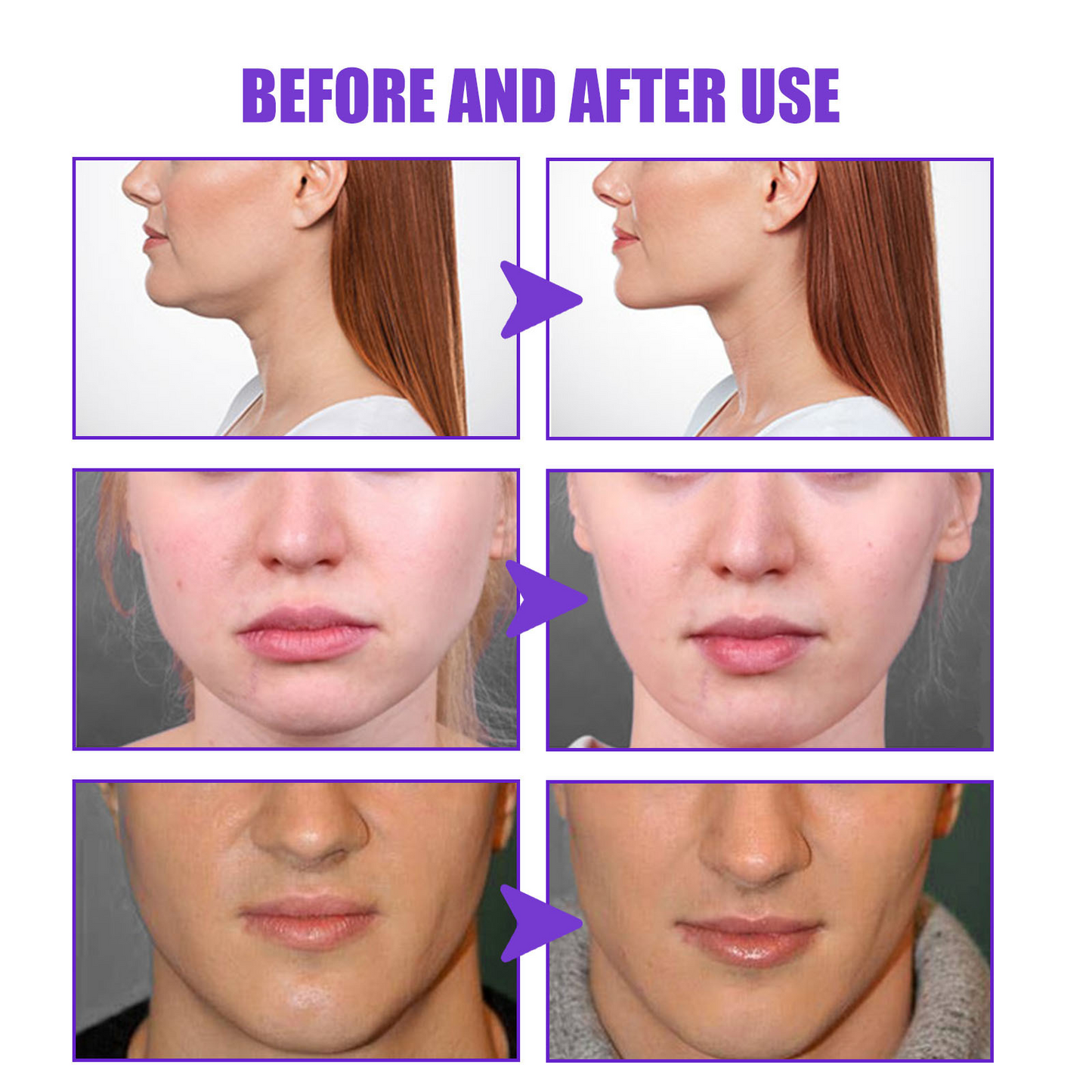 Firming Micro-Face Cream — Jawline & Facial Contour (30g)