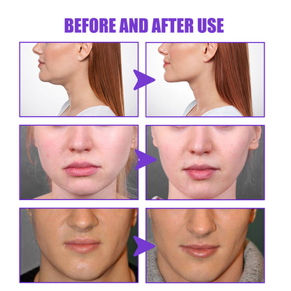 Firming Micro-Face Cream — Jawline & Facial Contour ( for a firmer, lifted look