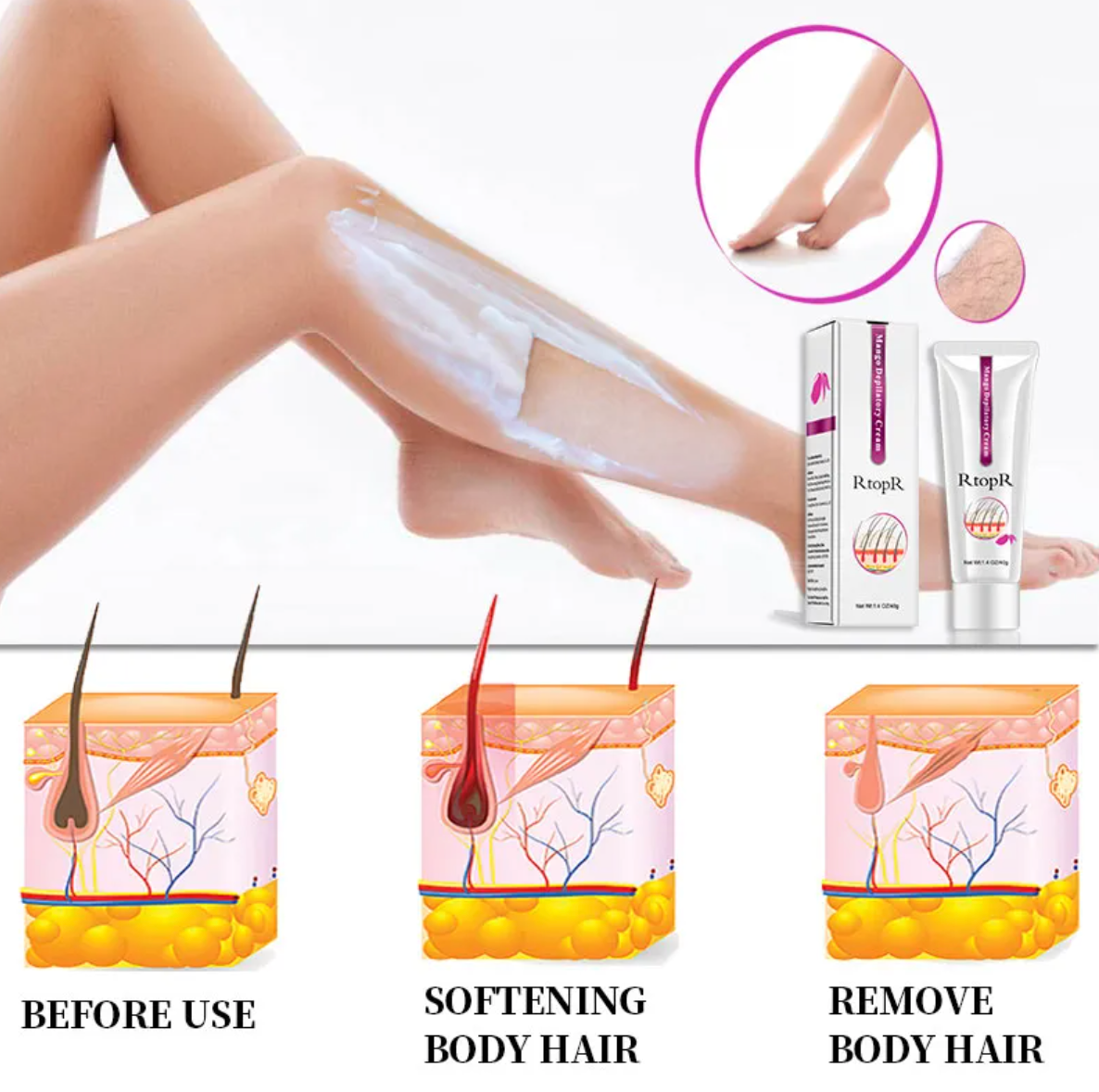 Gentle Hair Removal Cream – Smooth Skin Depilatory Formula