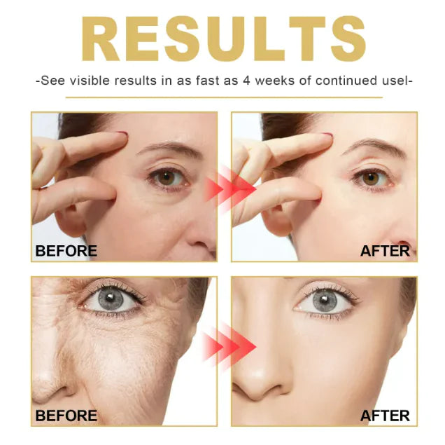 Anti-Wrinkle Deeply Moisturizing Face Cream – Dark Spot & Firming Formula