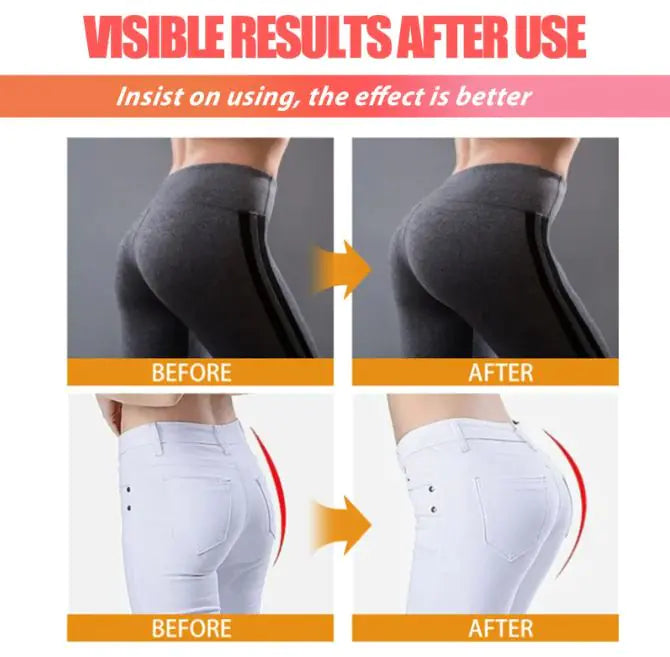 Butt Brightening Cream – Fruit Extract & Vitamin C Formula