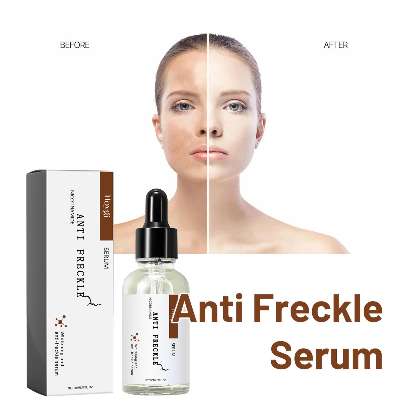 Niacinamide Anti-Freckle Brightening Serum – Whitening Formula, 30ml