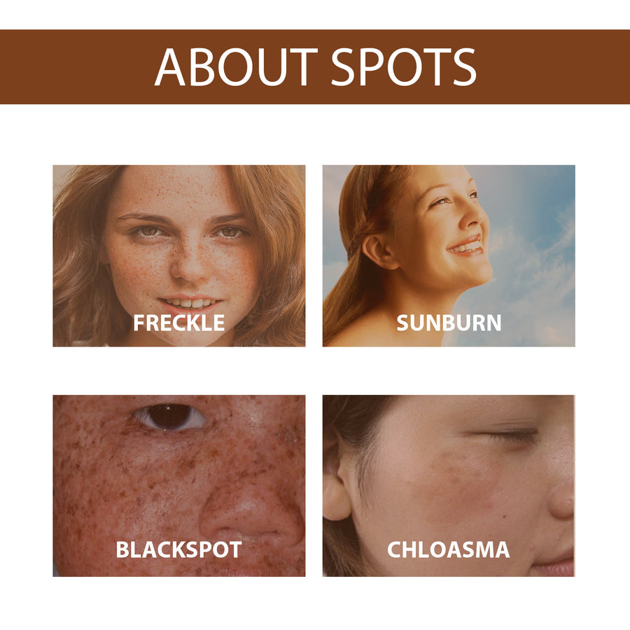 Niacinamide Anti-Freckle Brightening Serum powered by niacinamide
