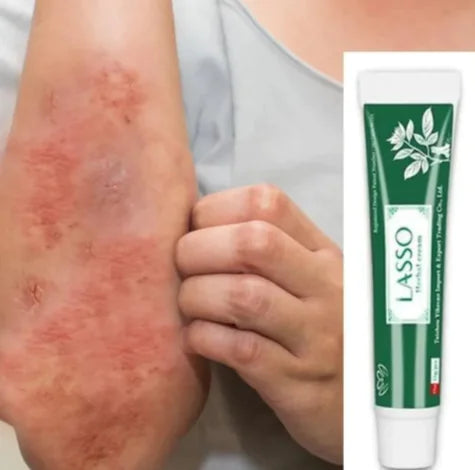 Herbal Clarifying & Soothing Face Cream – Gentle Daily Formula