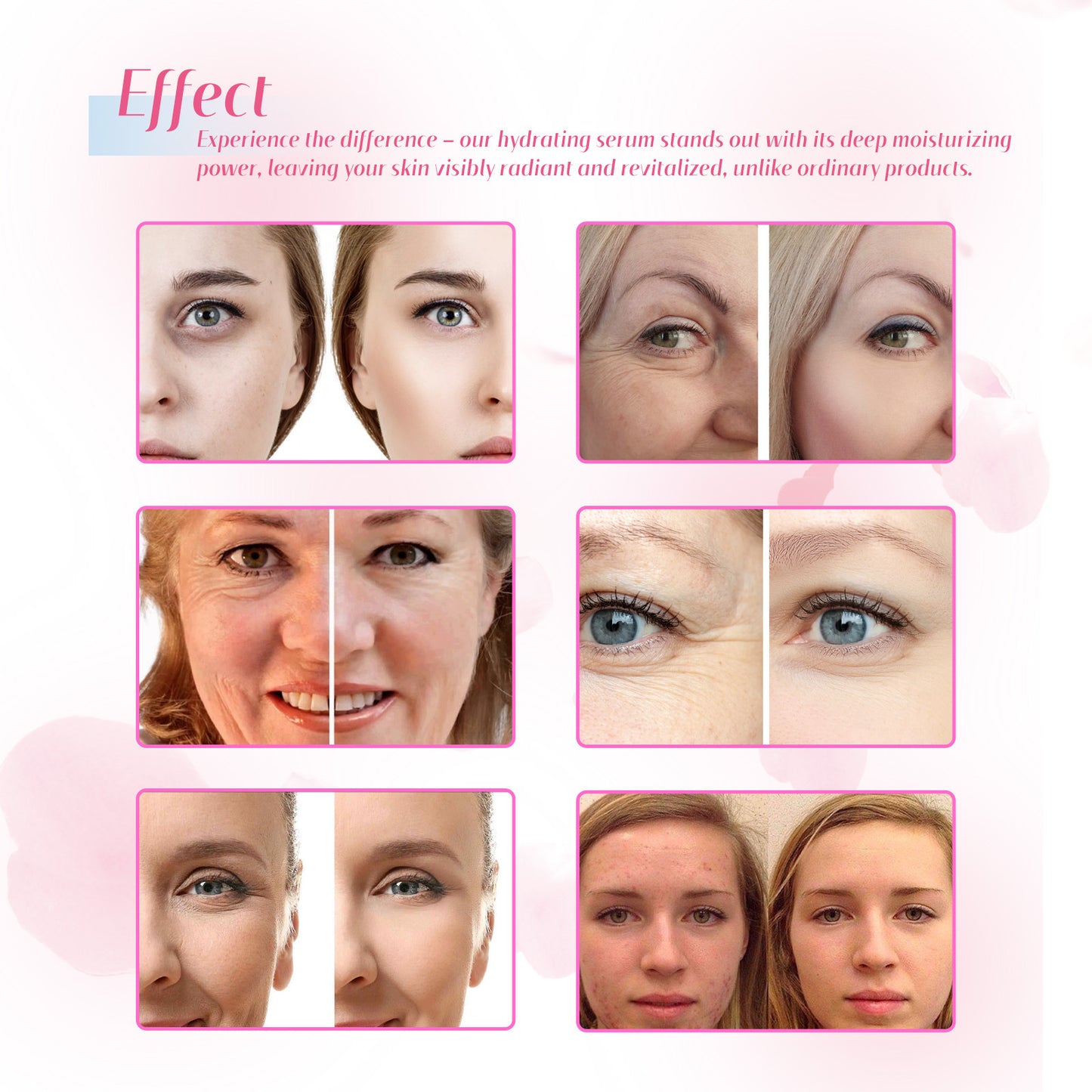 Rose Hydrating Serum – Rose Extract Deep Hydrating Formula, 30ml