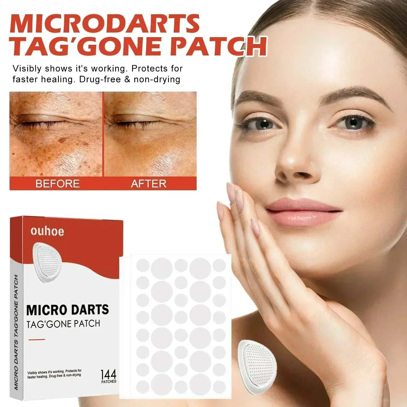 Close-up of Anti-Acne & Mole Repair Skin Patch showing hydrocolloid patches on skin