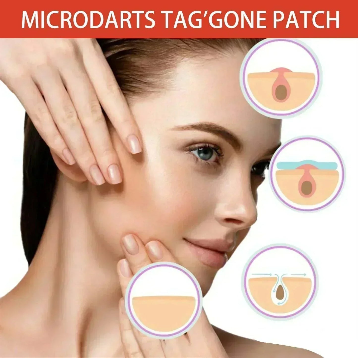 Woman applying Anti-Acne & Mole Repair Skin Patch to acne with packaging visible in the foreground