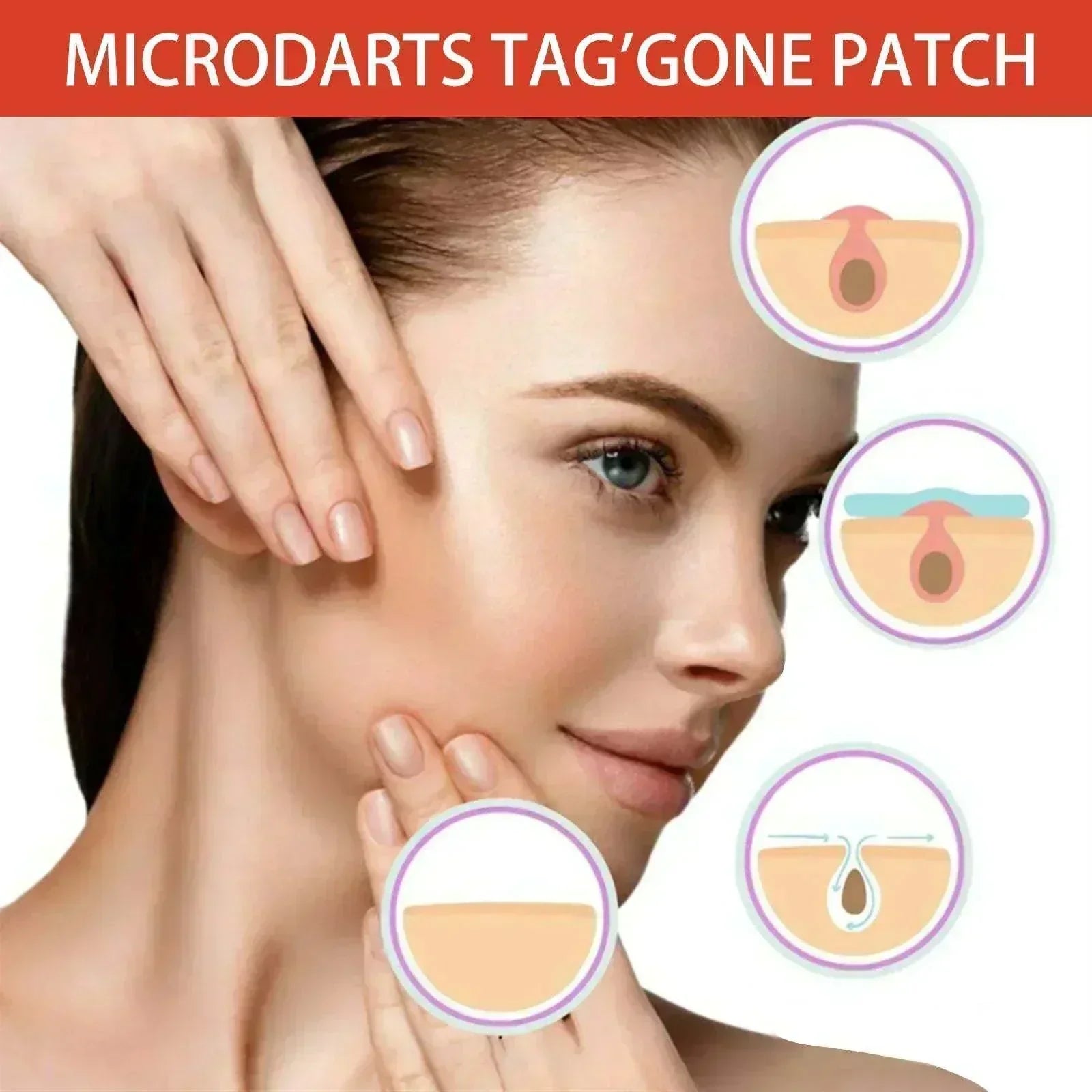 Woman applying Anti-Acne & Mole Repair Skin Patch to acne with packaging visible in the foreground