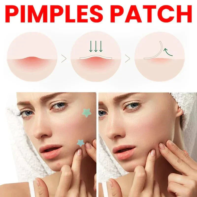 Desalting Pimple Spot Skin Repair Patch close-up view