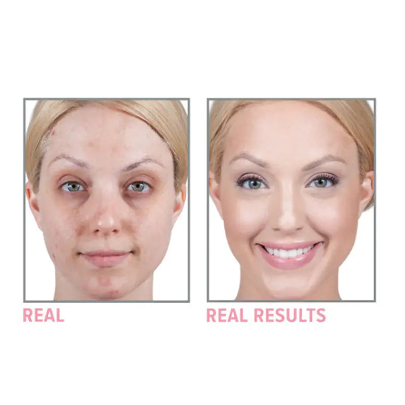 Super Moisturizing Anti-Wrinkle Face Cream – Firming Formula