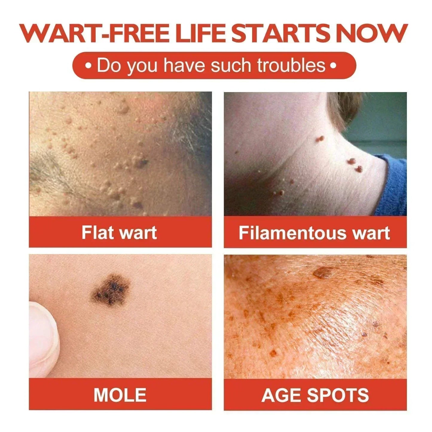 Diagram explaining how the Anti-Acne & Mole Repair Skin Patch absorbs impurities and heals blemishes