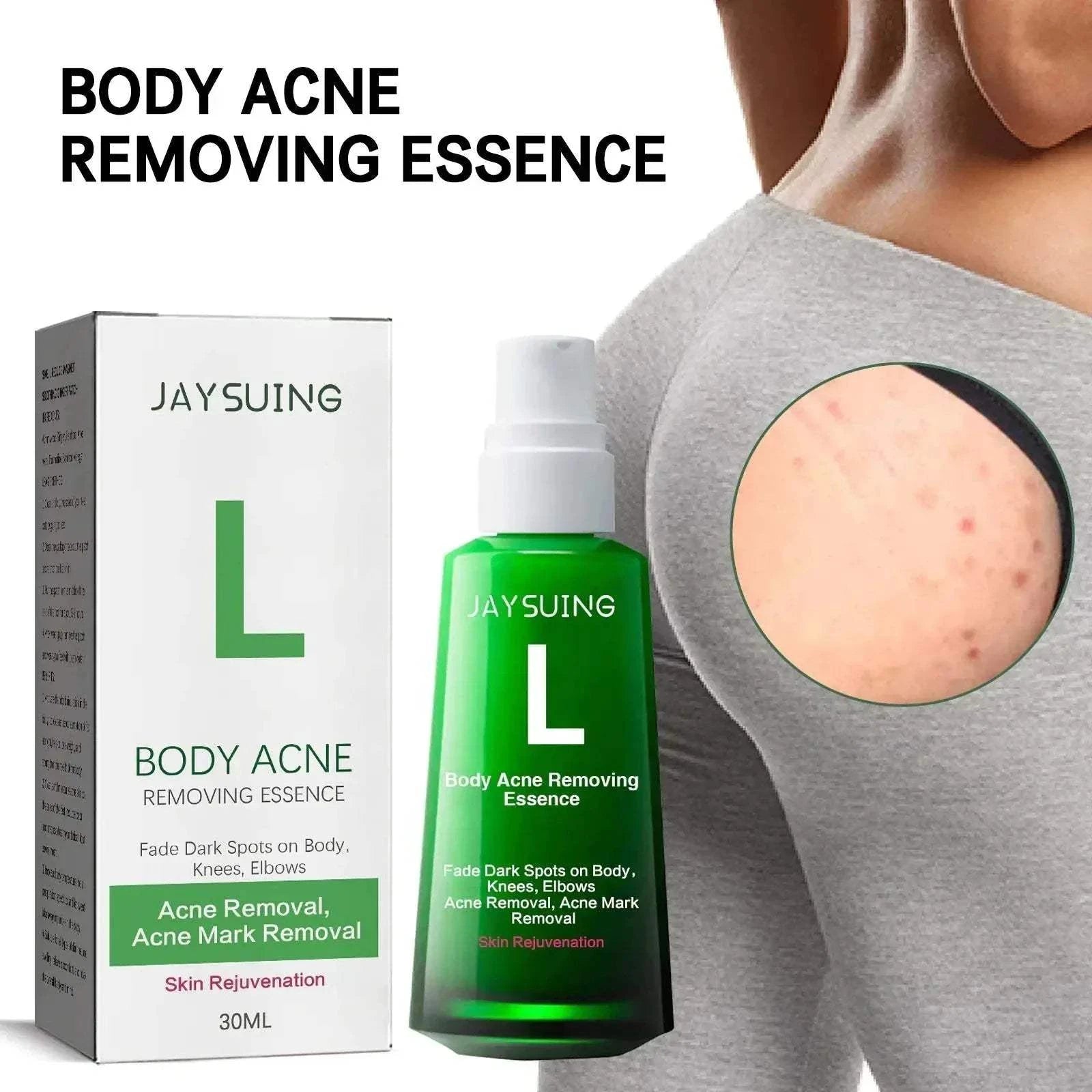 Spot Lightening Serum bottle with brightening skincare essence for reducing dark spots and evening skin tone