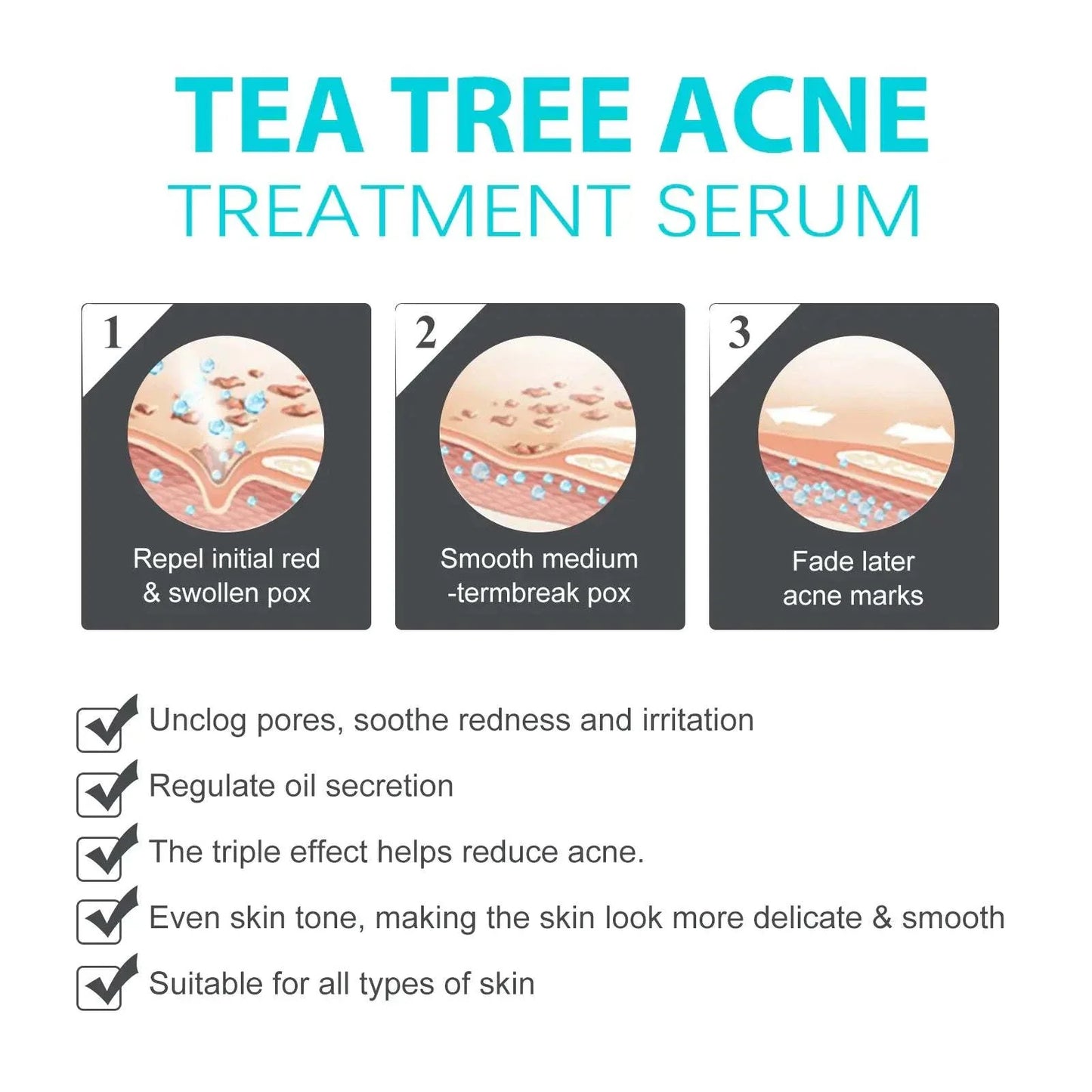 Jaysuing Whitening Anti-Acne Cream packaging and tube on white background