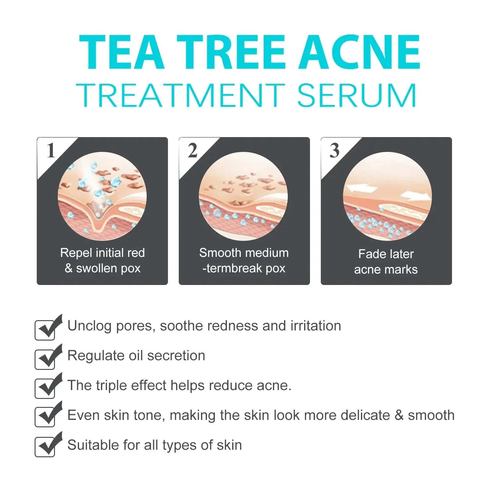 Jaysuing Whitening Anti-Acne Cream packaging and tube on white background
