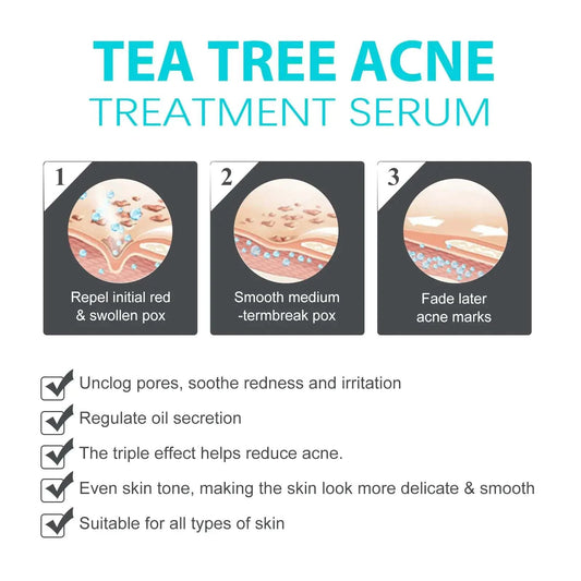Jaysuing Whitening Anti-Acne Cream packaging and tube on white background