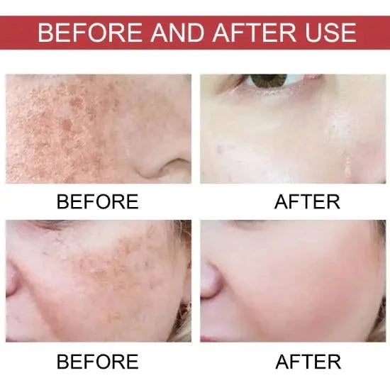 Before and after use comparison of skin treatment on a person's face.