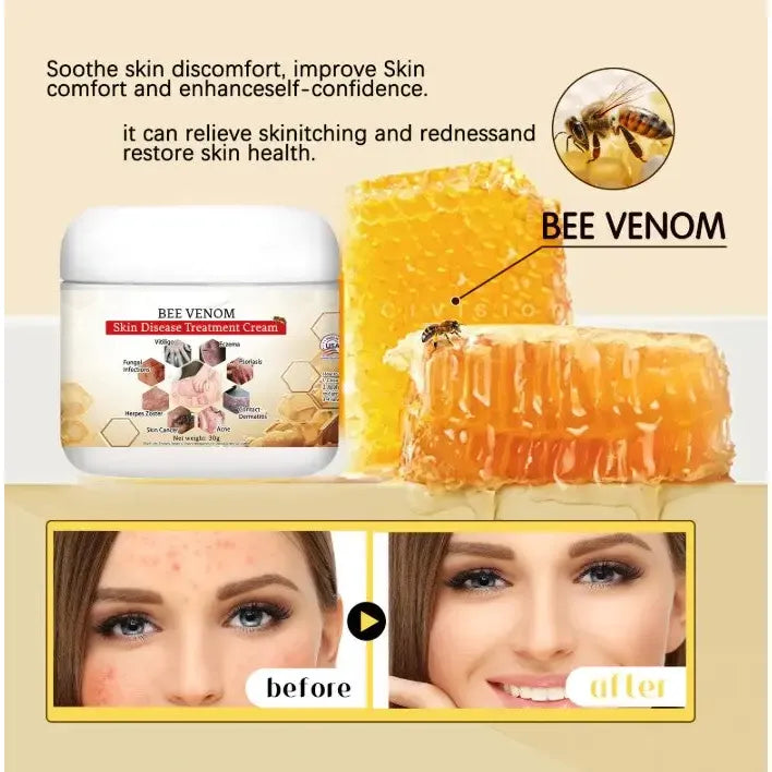 Bee Venom Soothing Cream The Bee Venom Store