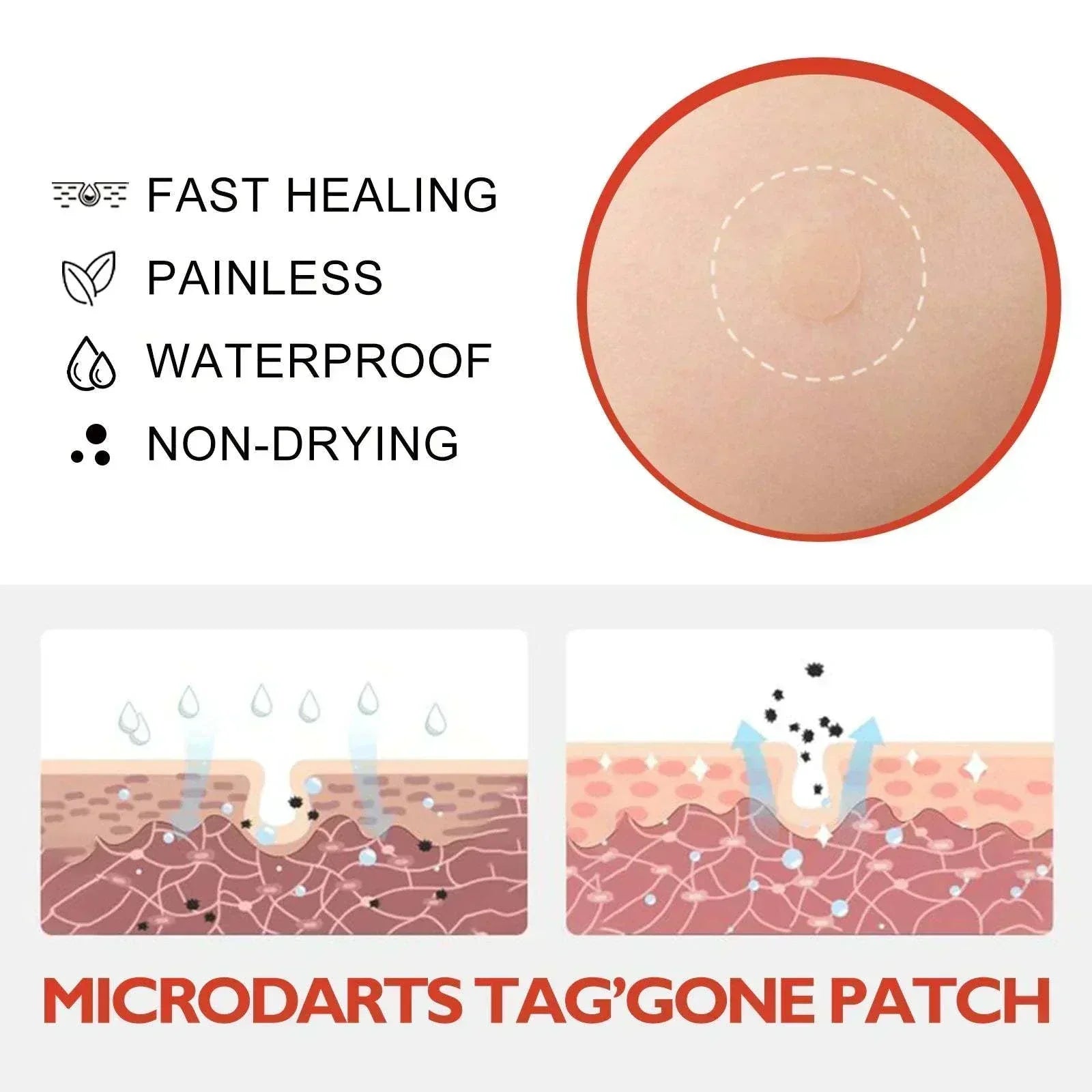 Illustrations of acne, skin tags, and moles with Anti-Acne & Mole Repair Skin Patch highlighted for treatment