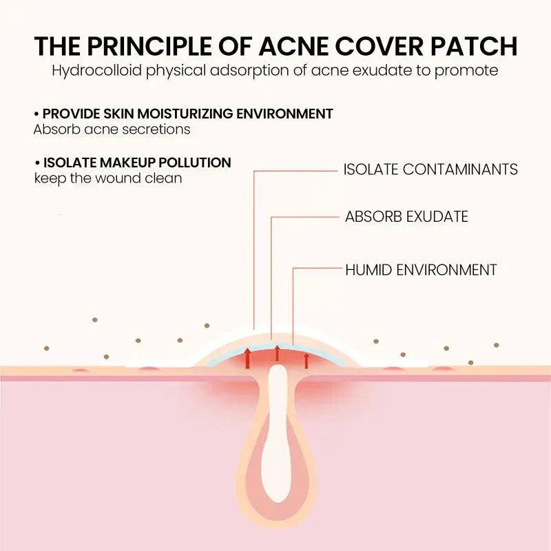 Desalting Pimple Spot Skin Repair Patch acne treatment dots
