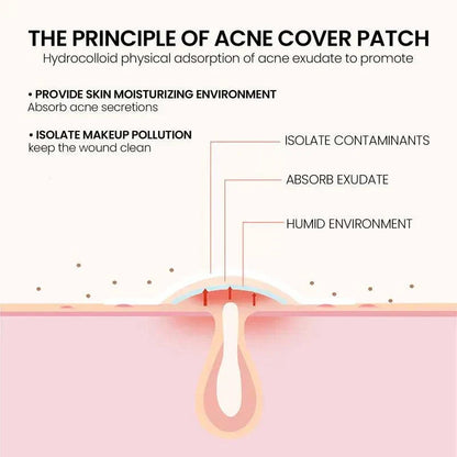 Pimple Spot Clarifying & Skin Repair Patch for all-over body care