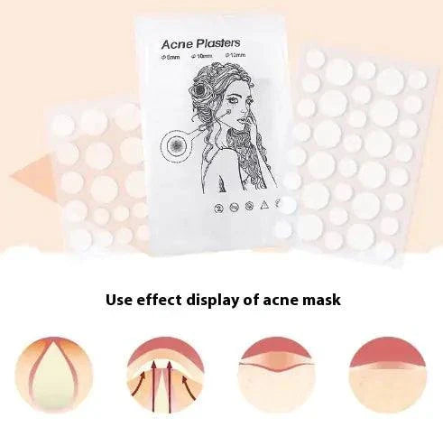 Acne plasters packaging with illustrations of a woman and acne stages on a beige background.
