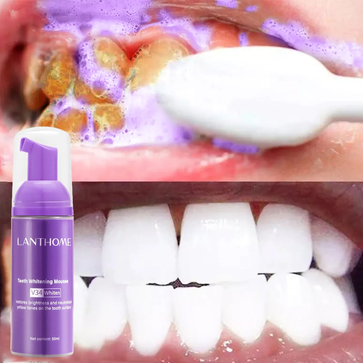 Oral Care Brightening Mousse – Daily Foam Formula