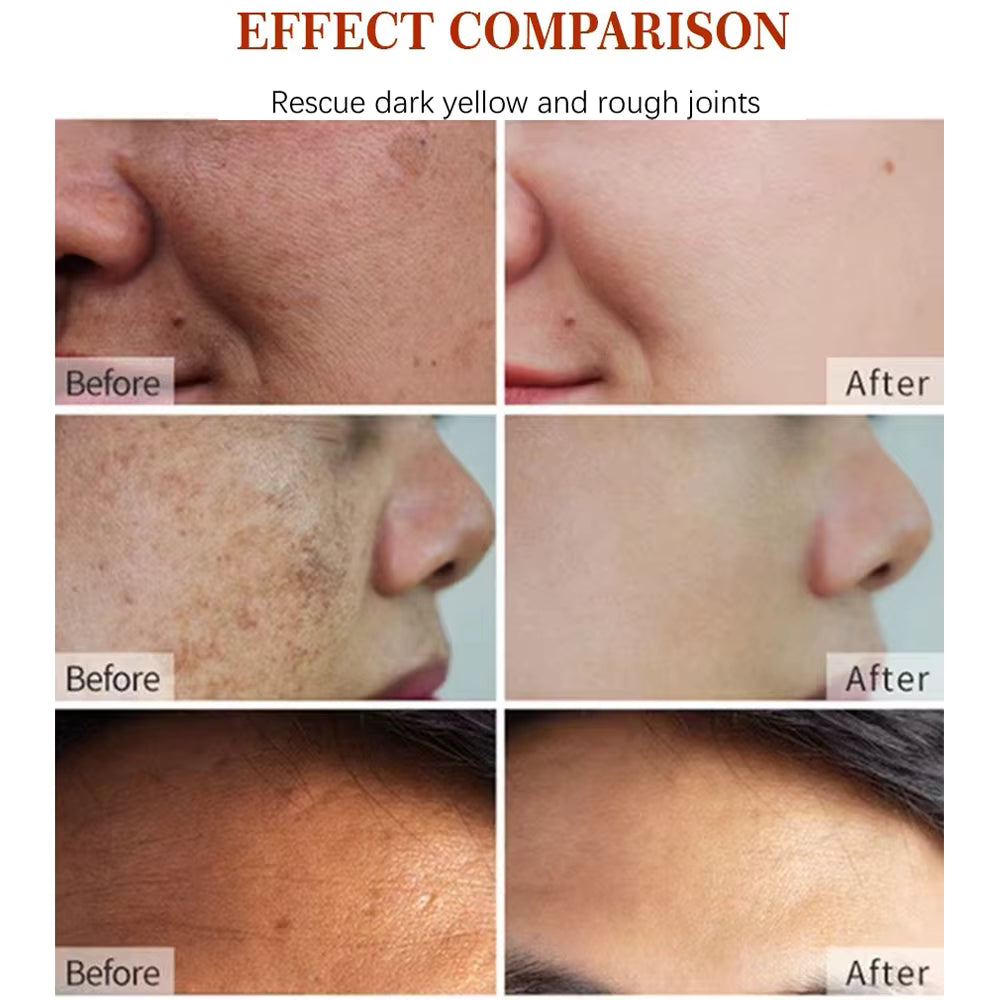Before and after effect comparison of skin treatment on a person's face.