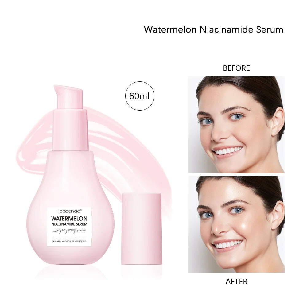 Watermelon Niacinamide Serum bottle with 'Before' and 'After' skin comparisons on a white background