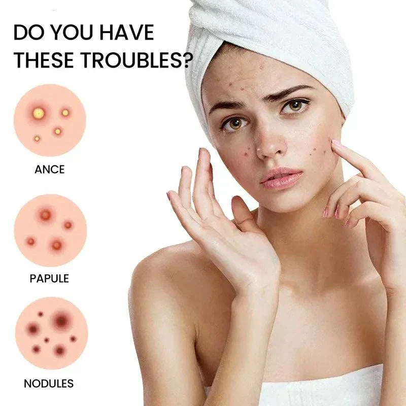 Desalting Pimple Spot Skin Repair Patch applied on skin