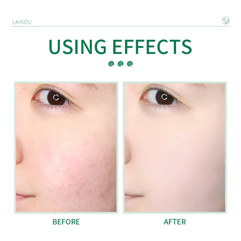 Centella Asiatica Facial Cleanser 50g for Pores Laikou
