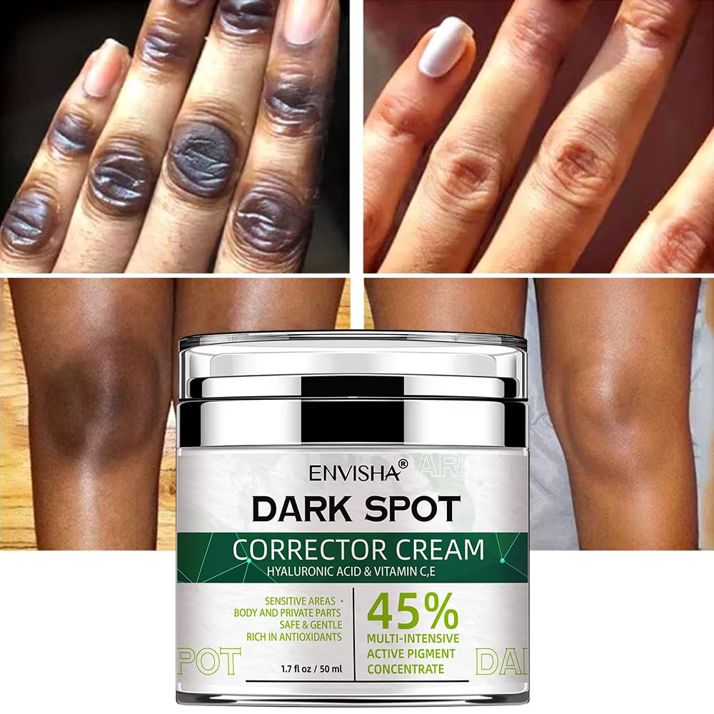 Collage of dark spots on skin with Envisha Dark Spot Corrector Cream packaging.
