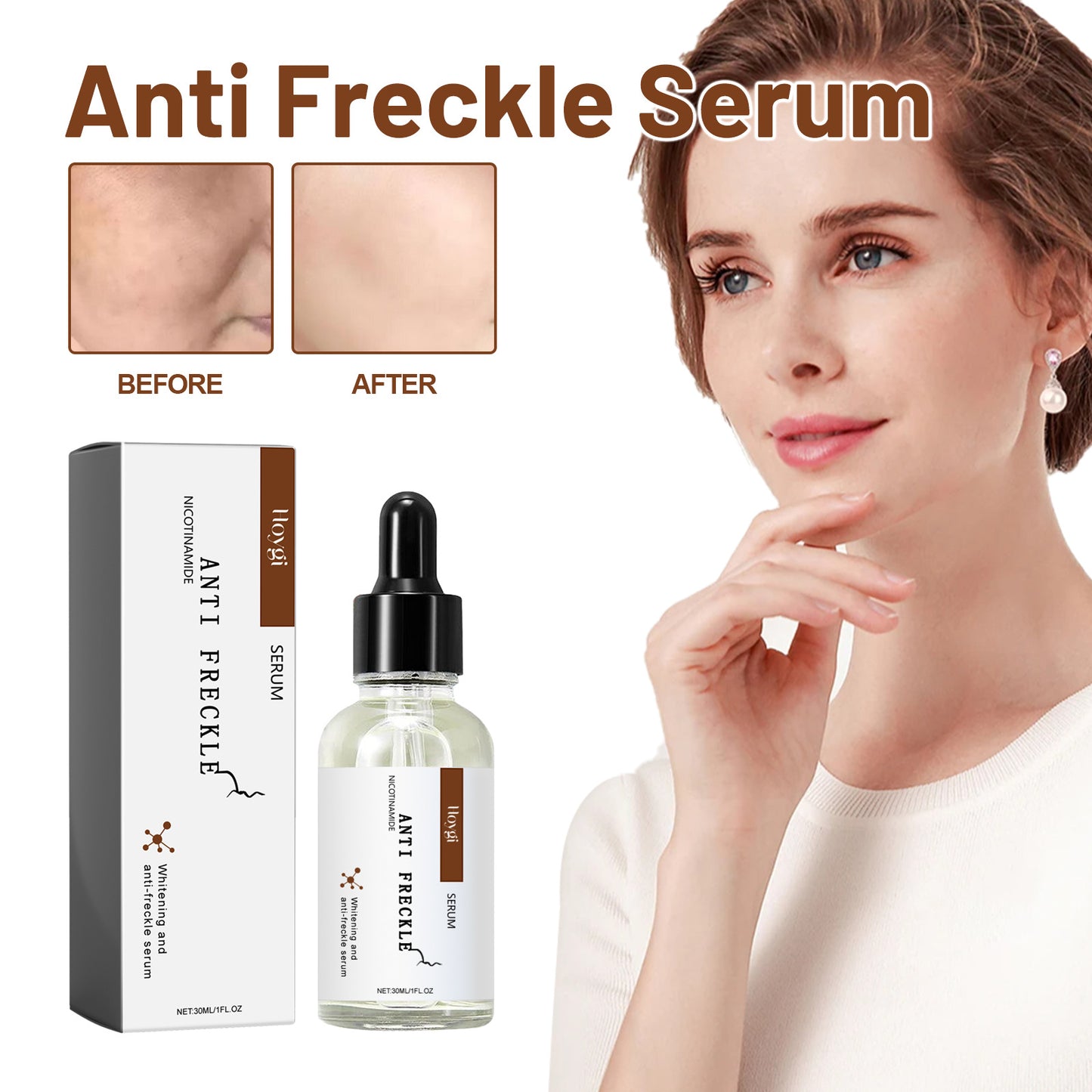 Niacinamide Anti-Freckle Brightening Serum – Whitening Formula, 30ml