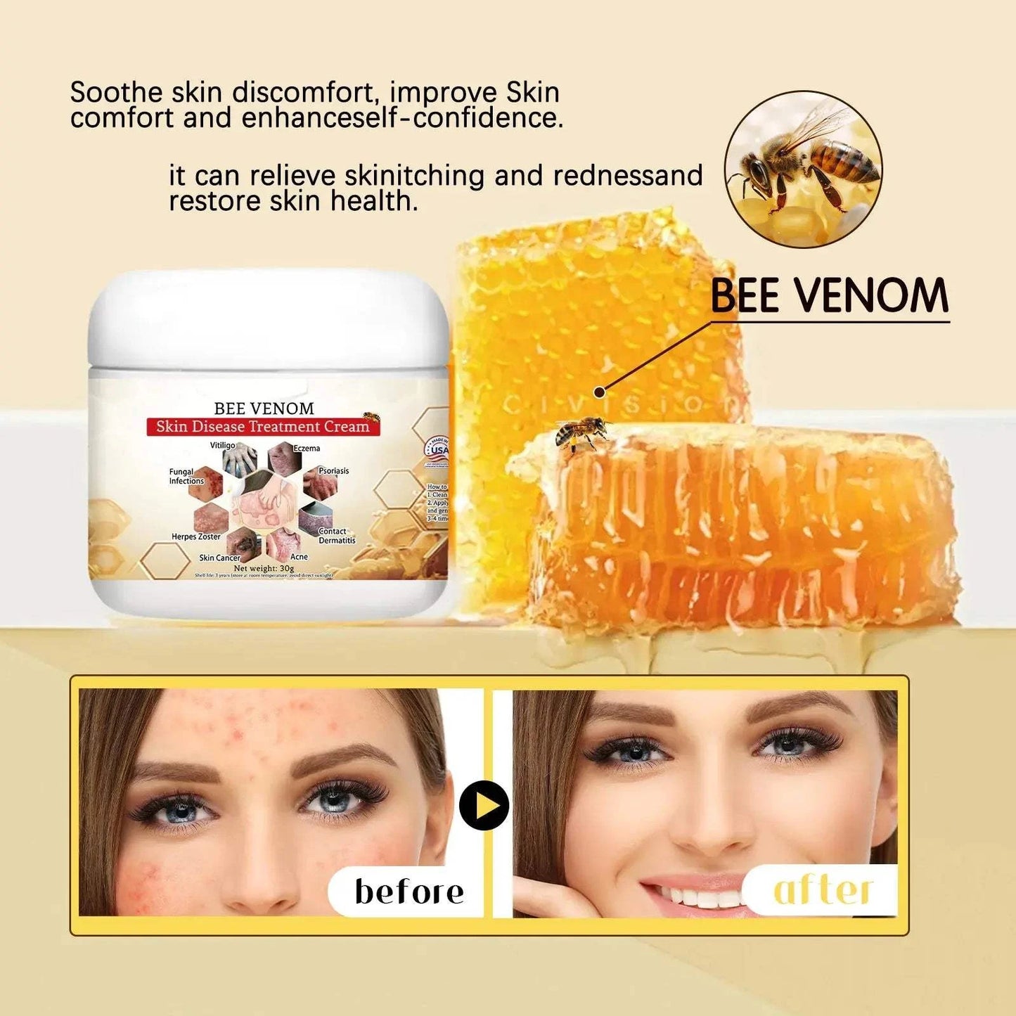 Bee Venom Soothing Cream The Bee Venom Store