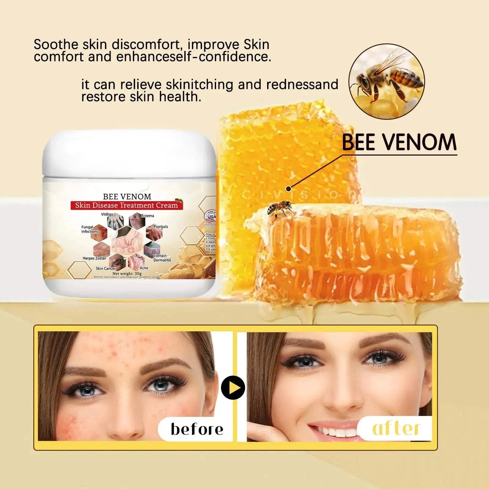 Bee Venom Soothing Cream The Bee Venom Store