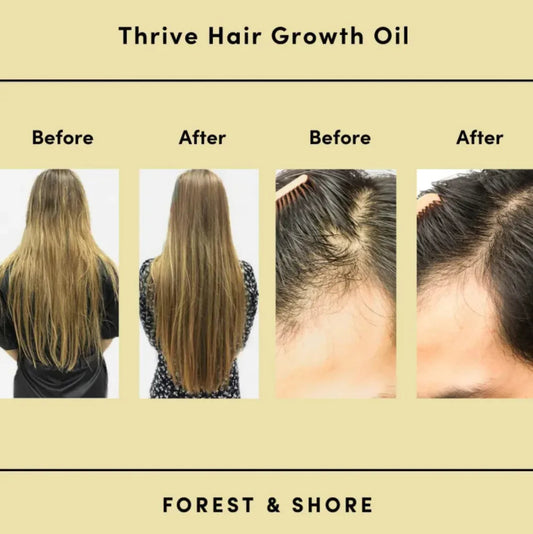 Rosemary Hair Care Essential Oil Bobbosow