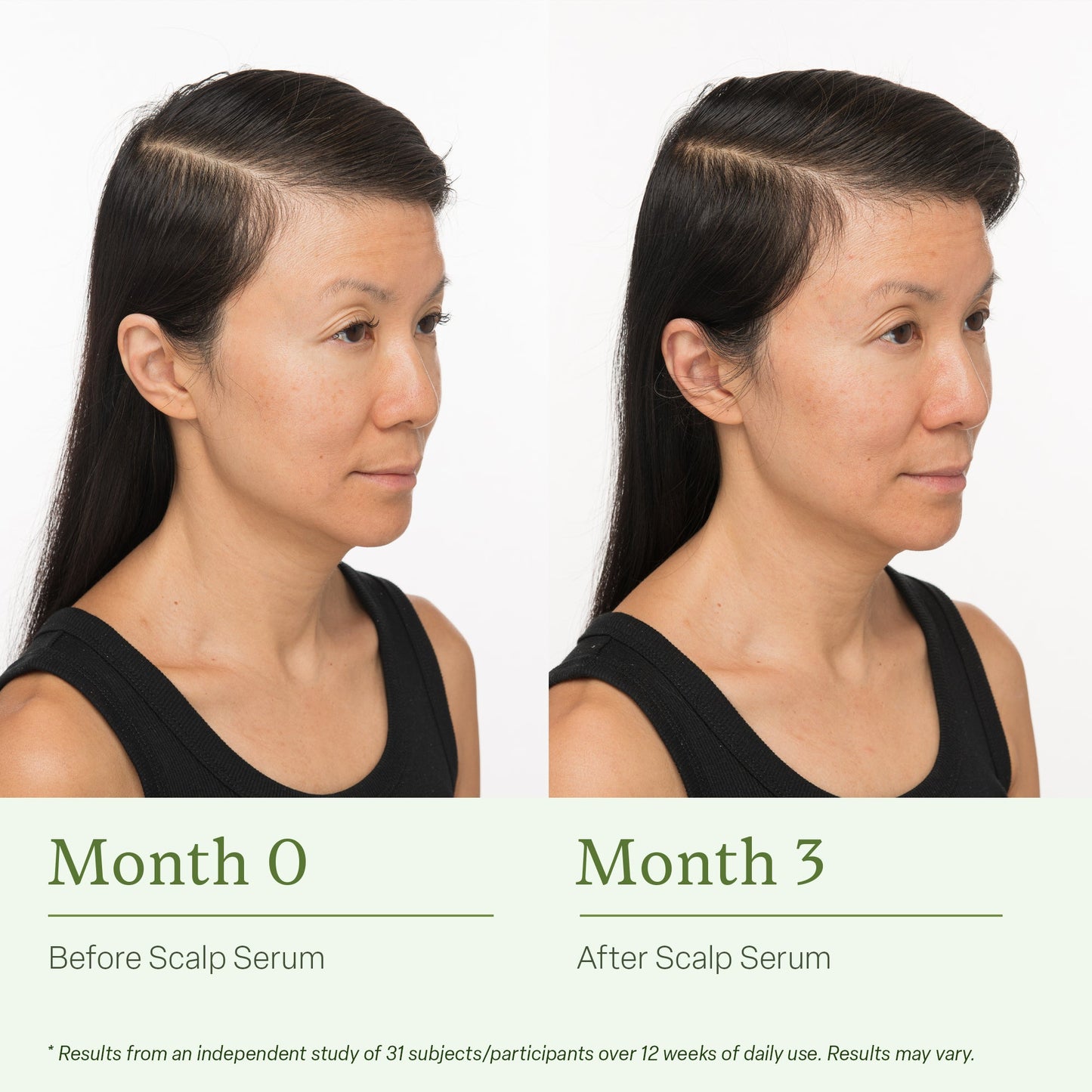 Divi Scalp Serum before and after results