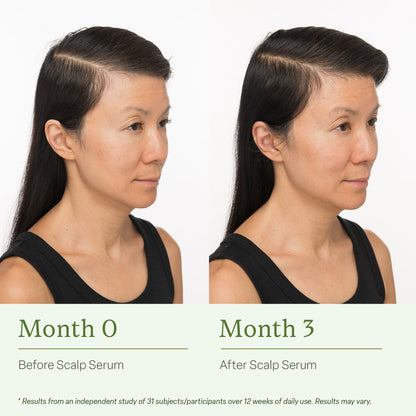 Divi Scalp Serum before and after results
