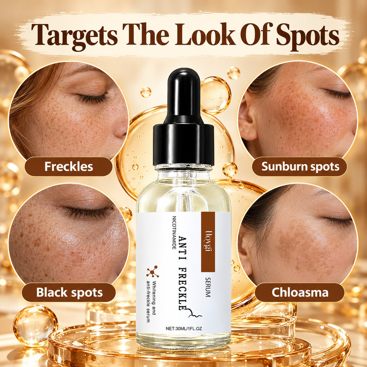 Hoygi Anti Freckle serum targets the look of freckles, sunburn spots, black spots and chloasma