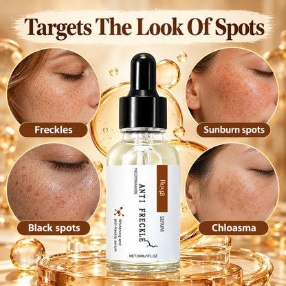Hoygi Anti Freckle serum targets the look of freckles, sunburn spots, black spots and chloasma